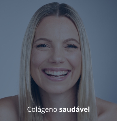 Colágeno saudável